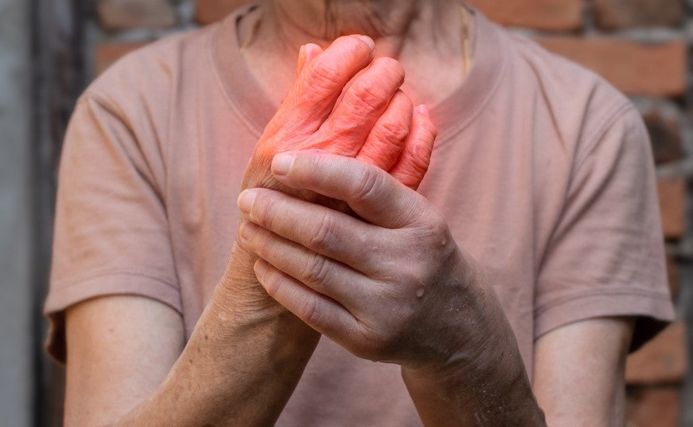 arthiritus.jpg__PID:14d31e00-5a3d-456c-bd2d-f949311d7d7d